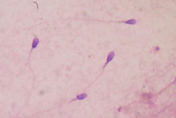 Phát hiện cấu trúc tinh trùng có thể góp phần gây vô sinh - 1 Phát hiện cấu trúc tinh trùng có thể góp phần gây vô sinh - 1