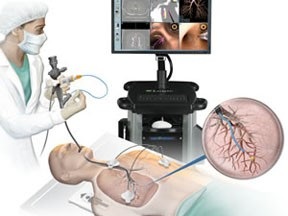 Bấm sinh thiết u phế quản, bệnh nhân bị chảy máu ồ ạt và tử vong - 1 Hình ảnh minh hoạ một ca nội soi phế quản.