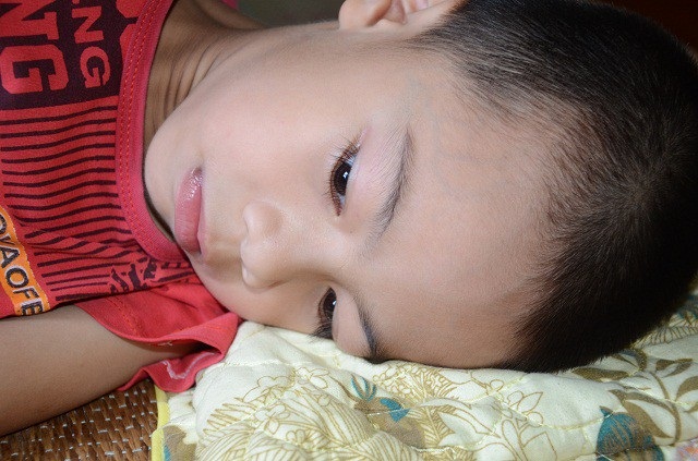 Chồng chết vì ung thư gan, mẹ lại đổ quỵ khi con mắc bệnh hiểm nghèo - 2 Hiện tại các cơn đau đầu thường xuyên hành hạ bé, vì không có tiền nên bé không được đến viện điều trị.