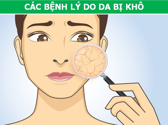 Mẹo giải quyết những “cơn ác mộng” lớn nhất của mùa hè - 6 Mẹo giải quyết những “cơn ác mộng” lớn nhất của mùa hè - 6