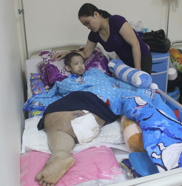 Sự sống mong manh của cậu bé mang chân phình to như… cột nhà - 5 Đã hai năm qua, cháu An mắc bệnh khiến kinh tế gia đình kiệt quệ