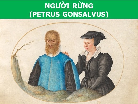 Những con người dị thường nhất từng xuất hiện trong lịch sử (Phần 1) - 1 Những con người dị thường nhất từng xuất hiện trong lịch sử (Phần 1) - 1
