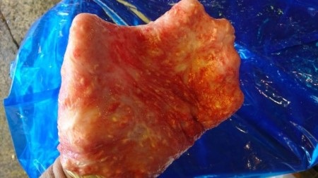 Dùng ruột cá "tự sướng", chàng trai đau đớn nhập viện - 2 Chàng trai vô danh đeo dạ dày cá như một chiếc găng tay