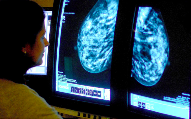 Nghiên cứu xem xét những người bị ung thư vú, tuyến tiền liệt, phổi hoặc ung thư đại trực tràng