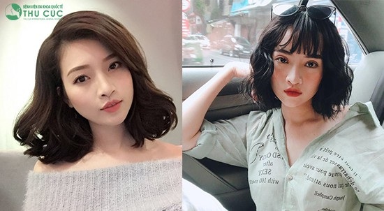 Giải mã xu hướng mắt to “bồ câu” của giới trẻ - 3 Đôi mắt trở nên long lanh sau khi thực hiện dịch vụ cắt mí mắt và gương mặt chuyên viên make-up Thảo Linh trẻ trung, cuốn hút hơn rất nhiều