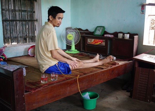 "Giữa thời bình, có ai khổ như tôi nữa không ?!" - 4 Trong khi đó Lưu Xuân Ba sau khi gặp tai nạn lao động đã trở thành người tàn phế, không thể tự chăm sóc mình
