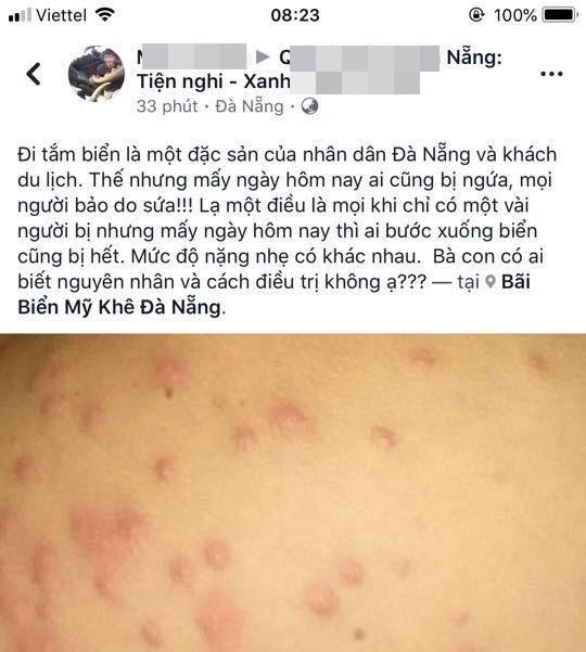 Trên trang Facebook Quảng lý đô thị Đà Nẵng, rất nhiều du khách cũng phản ánh tình trạng nổi ngứa khi tắm biển