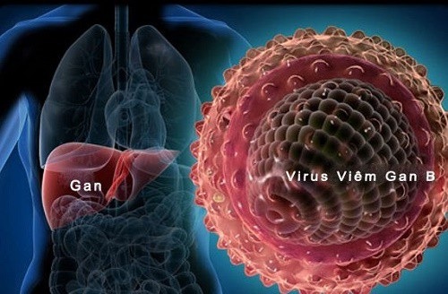 Tá hỏa phát hiện viêm gan sau khám định kỳ - 2 Tỷ lệ người mắc viêm gan B ở Việt Nam chiếm đến hơn 20%