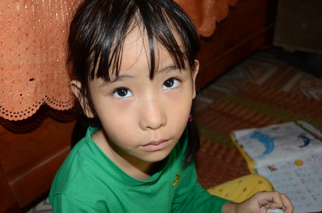 Ánh mắt đáng thương của bé 7 tuổi bị thiểu năng trí tuệ - 8 Ánh mắt và khuôn mặt đầy ám ảnh của bé gái 7 tuổi.