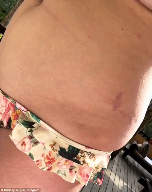 Chrissy Teigen không che giấu dáng sồ sề sau sinh - 3
Chrissy Teigen không che giấu các vết rạn da do tăng cân khi bầu bí