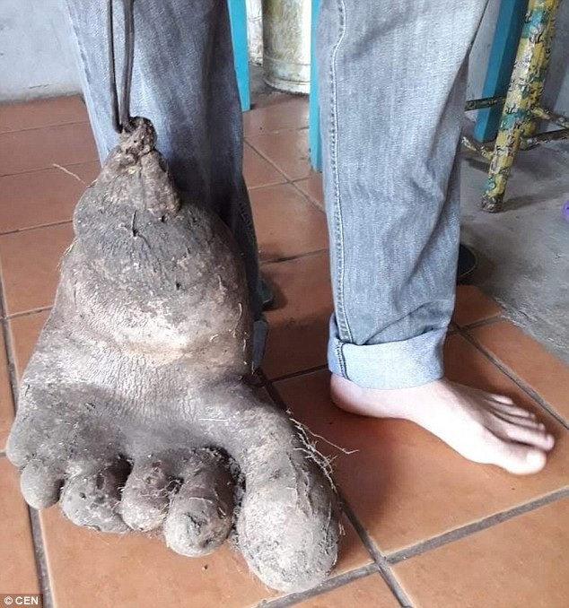 Củ khoai tây khổng lồ giống hệt bàn chân người - 3 Củ khoai khổng lồ có hình giống bàn chân người.