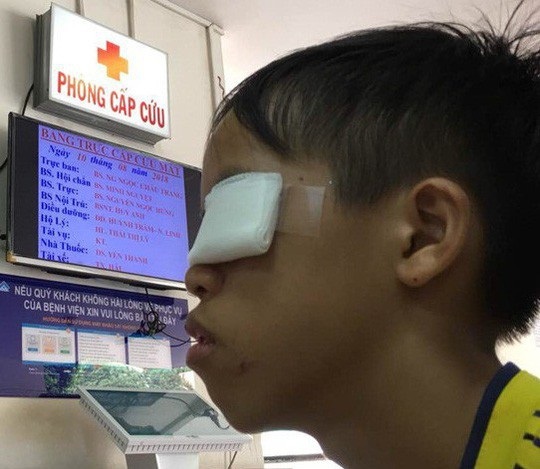 Dùng thuốc đầu que diêm làm pháo, bé trai bị hỏng mắt - 1 Bé trai dùng thuốc pháo ở đầu que diêm gây nổ bị hỏng mắt trái