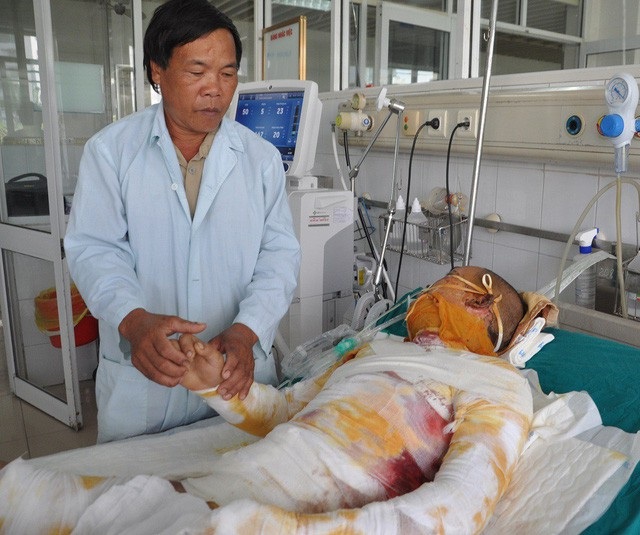 Hơn 61 triệu đồng đến với anh Sa Văn Liên - 1 Em Tha dùng xăng tẩm để đi bắt ong nên bị bỏng nặng.