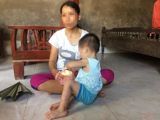 Tìm ra đường lây HIV cho bé 18 tháng tuổi khiến chuyên gia bất ngờ? - 1
Em bé 18 tháng tuổi nhiễm HIV trong khi bố mẹ lại bình thường khiến các chuyên gia rất quan tâm tìm đường lây truyền bệnh của bé. Ảnh: Trần Thanh.