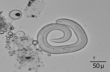 
Ấu trùngAngiostrongylus cantonensis- Ảnh từ H. Wanget al/Am. J. Trop. Med. Hyg.2018.
