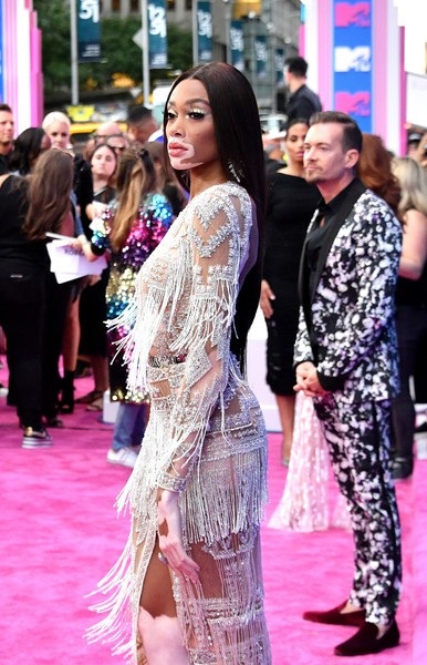 Hai siêu mẫu đọ dáng với trang phục xuyên thấu - 11
Winnie Harlow đảm nhiệm vai trò MC thảm đỏ