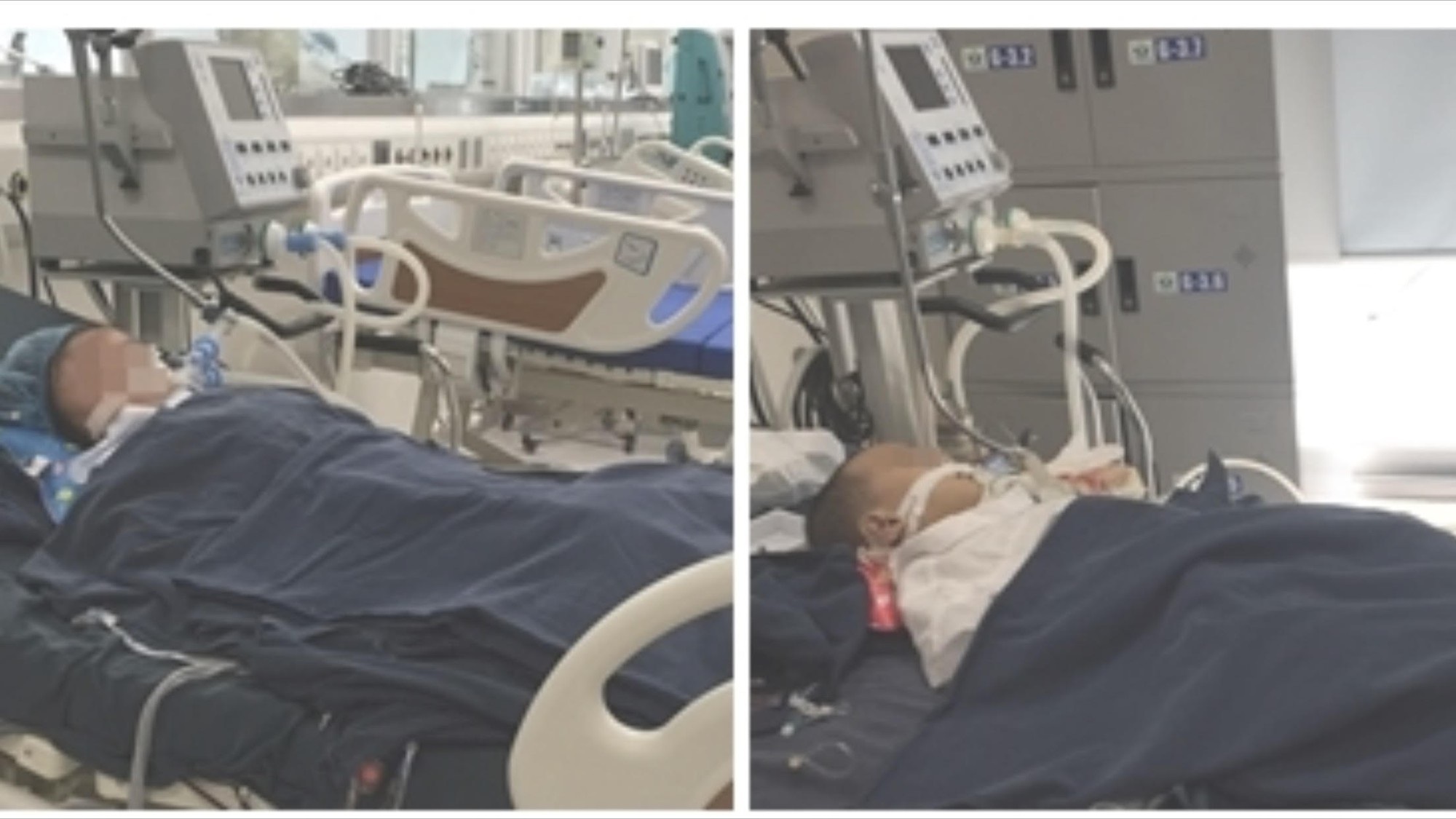 Cùng một ngày, 3 bệnh nhi bị ong đốt nguy kịch - Ảnh 1. Cùng một ngày, 3 bệnh nhi bị ong đốt nguy kịch - Ảnh 1.