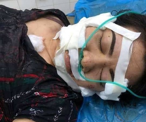 Cuộc đời đầy bi kịch của người đàn bà - 1 Chị Oanh lúc đang cấp cứu tại bệnh viện.