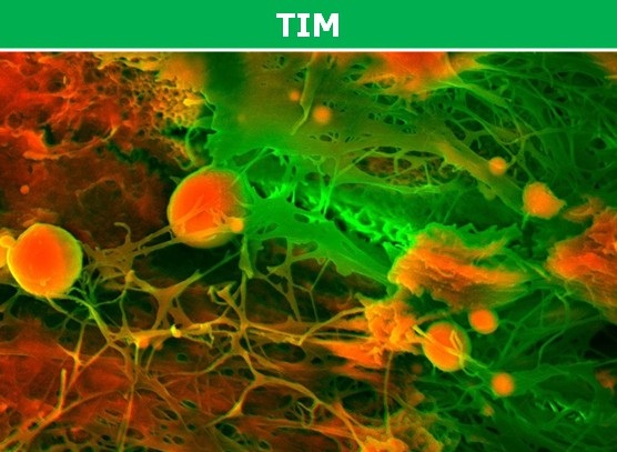 Các bộ phận trên cơ thể chúng ta trông thế nào dưới ống kính hiển vi? - 5 Thứ mà bạn đang thấy chính là hình phóng đại của trái tim người, mà cụ thể hơn là động mạch vành – hệ thống mạch máu có chức năng nuôi dưỡng quả tim.