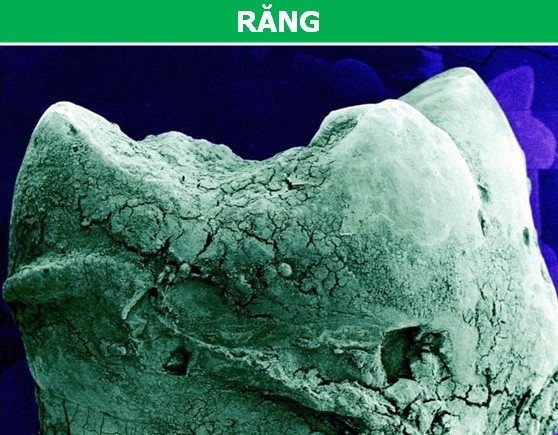 Các bộ phận trên cơ thể chúng ta trông thế nào dưới ống kính hiển vi? - 9 Thứ trông y hệt một núi đá vôi trong hình thực chất là răng của chúng ta.