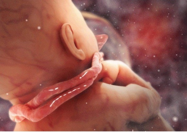 Dây rốn thai nhi và những điều mẹ chưa biết - 1 Dây rốn quấn cổ thực chất không thể làm trẻ đau và không gây nguy hiểm cho trẻ khi trẻ vẫn còn ở trong bụng mẹ