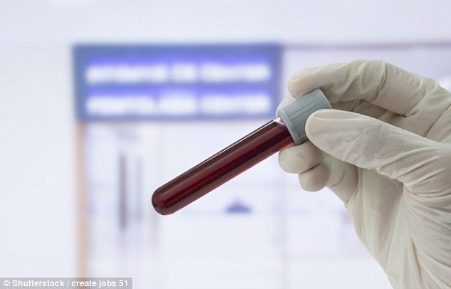 Hy hữu trường hợp con lây nhiễm HIV từ cha - 1 Trong một trường hợp vô cùng hy hữu, một bé trai bị lây nhiễm HIV từ cha sau khi chào đời ở Bồ Đào Nha. Sau nhiều năm nghiên cứu, các nhà khoa học kết luận em bé bị lây bệnh do tiếp xúc với chất dịch chảy ra từ nốt mụn trên tay của người cha