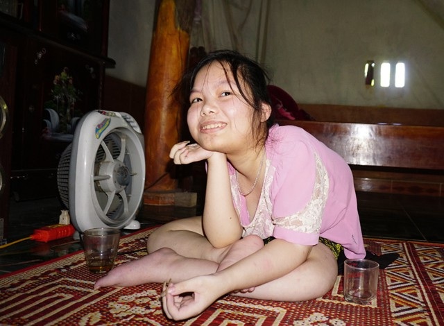 Người cha 10 năm "vác" 2 con đi học - 3
Nguyễn Thị Sương cũng mắc căn bệnh giống em trai. Năm nay vào cấp 3, Sương phải nghỉ học. Em đang dự tính học thêu tranh để có thêm thu nhập phụ bố mẹ.
