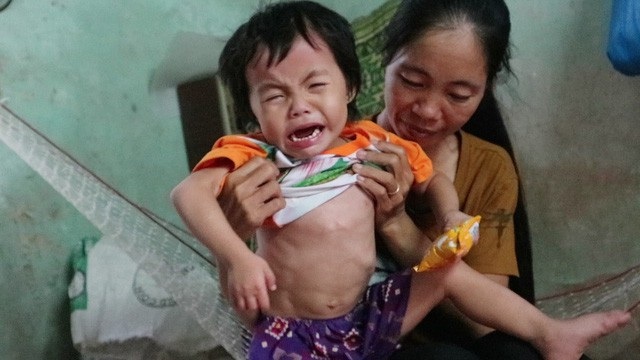 Bệnh viện Tim Hà Nội phẫu thuật miễn phí cho bé Trần Thị Như Ý - 2 Gia đình bé đã kiệt quệ vì không biết lấy đâu ra tiền để cứu con.