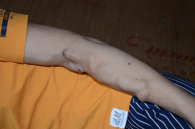 Nỗi đớn đau của người phụ nữ suy thận giai đoạn cuối, 2 lần mất con - 4 Lại liên tiếp mất đi 2 đứa con, khiến chị suy sụp, sức khỏe ngày càng suy kiệt.