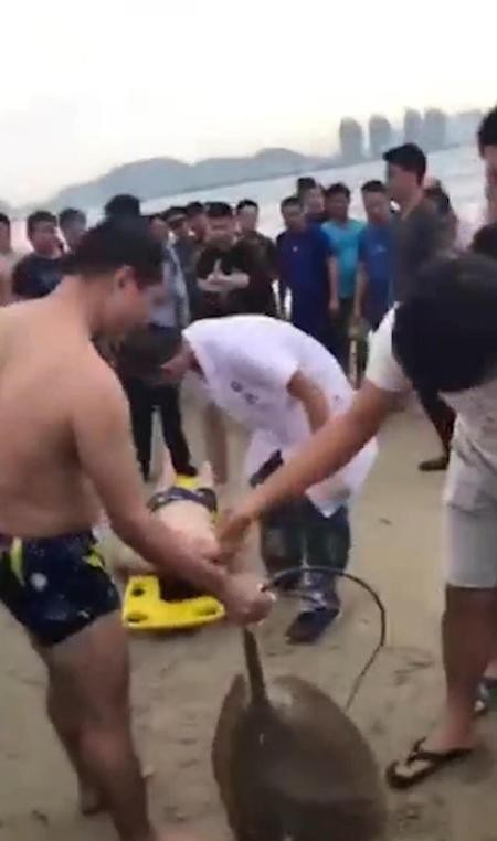 Tình cảnh éo le: Đi tắm biển bị cá đuối gai độc đâm vào “chỗ hiểm” - 3 Một người đi biển khác đã giúp tách con cá đuối gai độc ra và con cá có vẻ đã qua đời ngay trên bãi biển