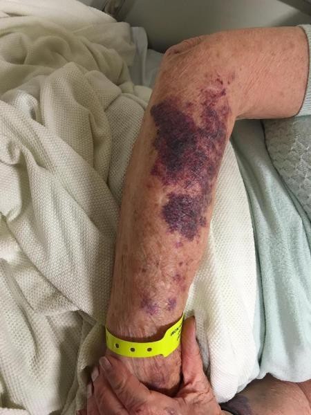 Cụ bà vô cùng dũng cảm dù đã lớn tuổi và có 3 người con, 8 người cháu, 11 người chắt