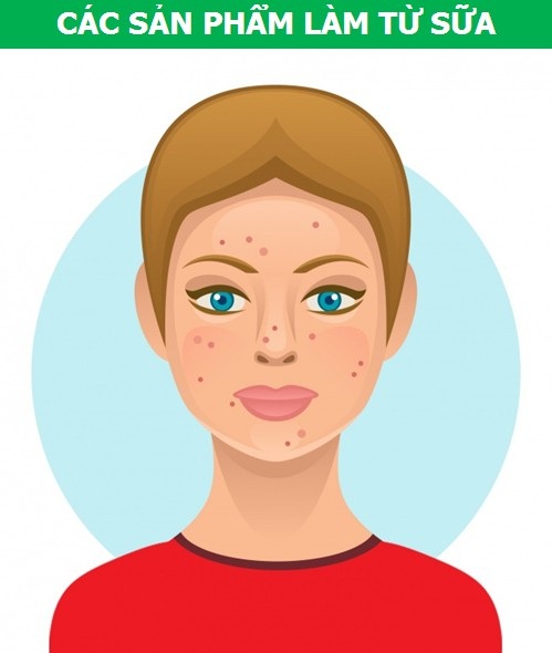 Các món ăn khoái khẩu có thể gây hại cho làn da - 1