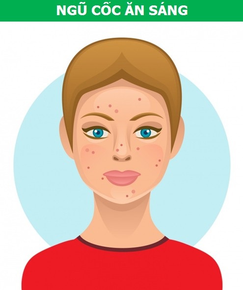 Các món ăn khoái khẩu có thể gây hại cho làn da - 2