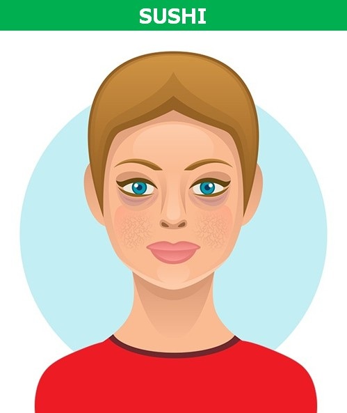 Các món ăn khoái khẩu có thể gây hại cho làn da - 5