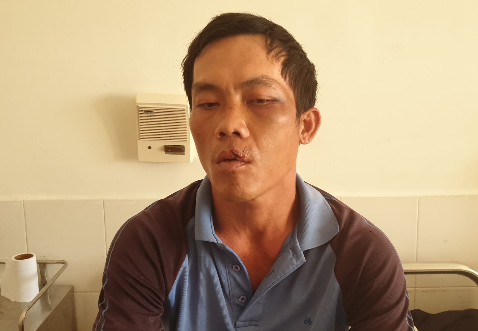 Điều tra việc một người dân bị trói, đánh, phơi nắng tại dự án Điện mặt trời - 1 Điều tra việc một người dân bị trói, đánh, phơi nắng tại dự án Điện mặt trời - 1