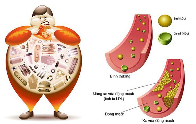 Giảm mỡ máu hiệu quả với dược liệu thiên nhiên - 3 Giảm mỡ máu hiệu quả với dược liệu thiên nhiên - 3