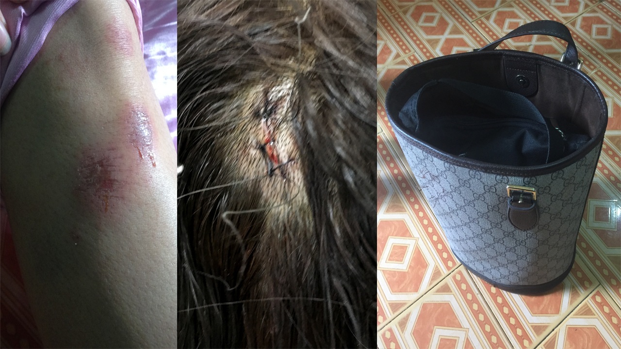 Clip cô gái bị giật túi xách kéo lê theo xe máy ngã đập đầu xuống đất! Phải xử trí thế nào nếu không may bị cướp?