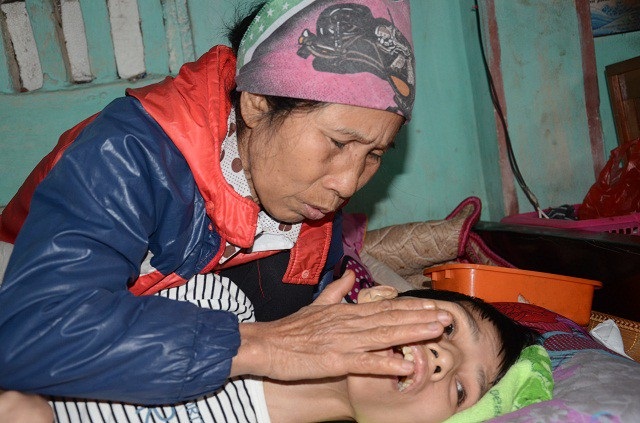 Sự sống mong manh của cô gái trẻ mắc căn bệnh hiếm gặp - Ảnh 9. Sự sống mong manh của cô gái trẻ mắc căn bệnh hiếm gặp - Ảnh 9.