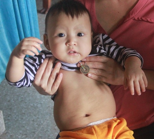 Tiếng khóc xé lòng của bé trai 15 tháng tuổi đã sớm mắc bệnh u gan - Ảnh 4. Tiếng khóc xé lòng của bé trai 15 tháng tuổi đã sớm mắc bệnh u gan - Ảnh 4.