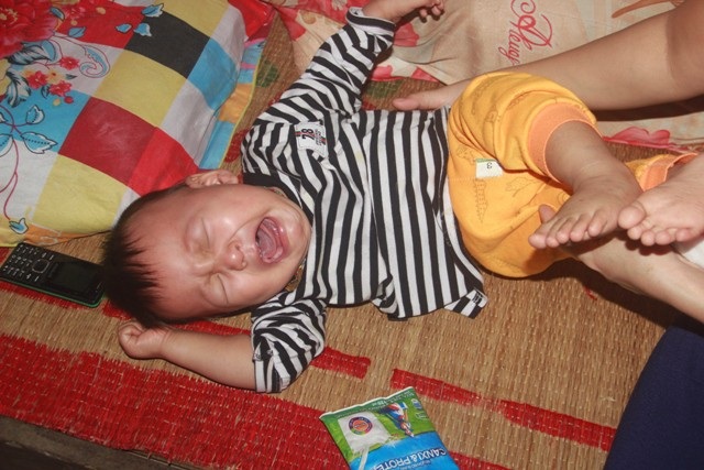 Tiếng khóc xé lòng của bé trai 15 tháng tuổi đã sớm mắc bệnh u gan - Ảnh 7. Tiếng khóc xé lòng của bé trai 15 tháng tuổi đã sớm mắc bệnh u gan - Ảnh 7.