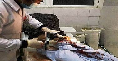 Nam thanh niên bị đâm nhiều nhát khi can ngăn nhóm đối tượng lạ đánh bạn - Ảnh 1. Nam thanh niên bị đâm nhiều nhát khi can ngăn nhóm đối tượng lạ đánh bạn - Ảnh 1.