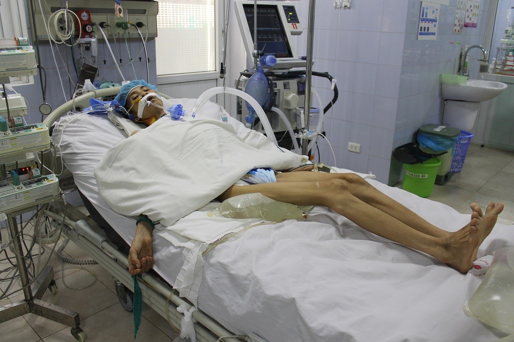 Mẹ đơn thân người dân tộc Mường nguy kịch vì suy tim nặng - Ảnh 2. Mẹ đơn thân người dân tộc Mường nguy kịch vì suy tim nặng - Ảnh 2.