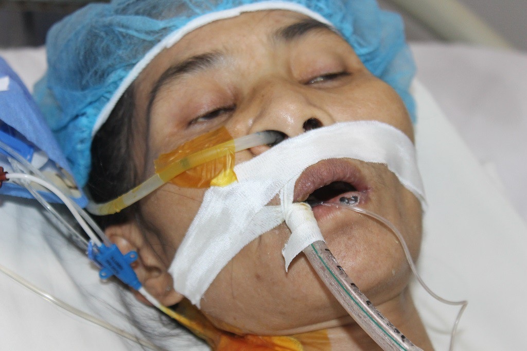 Mẹ đơn thân người dân tộc Mường nguy kịch vì suy tim nặng - Ảnh 3. Mẹ đơn thân người dân tộc Mường nguy kịch vì suy tim nặng - Ảnh 3.