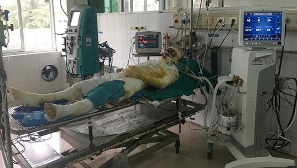 Lấy nước mắm, mỡ trăn chữa bỏng, ruồi nhặng theo bệnh nhân vào tận viện - Ảnh 1. Lấy nước mắm, mỡ trăn chữa bỏng, ruồi nhặng theo bệnh nhân vào tận viện - Ảnh 1.