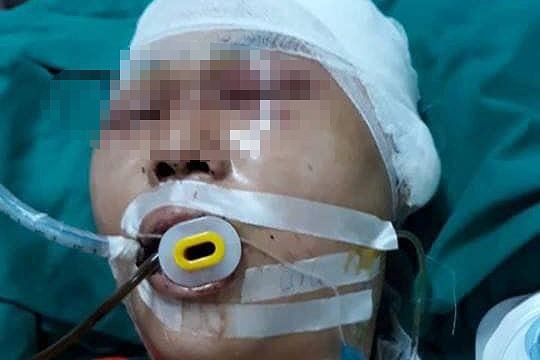 Hà Nội: Nam học sinh bị đánh chấn thương sọ não ở gần nhà - Ảnh 1. Hà Nội: Nam học sinh bị đánh chấn thương sọ não ở gần nhà - Ảnh 1.