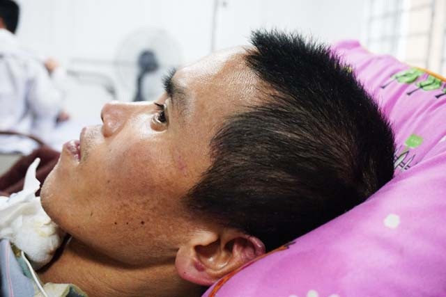 Cảnh sống mòn của người đàn ông bị nạn trên đường về đưa vợ đi sinh - 1 Cú tai nạn giao thông khi trên đường về đưa vợ đi sinh khiến anh Vũ Đức Thiện bị chấn thương sọ não, liệt nửa người. Hiện một phần hộp sọ đang được nuôi cấy, chờ phẫu thuật ghép xương sọ.