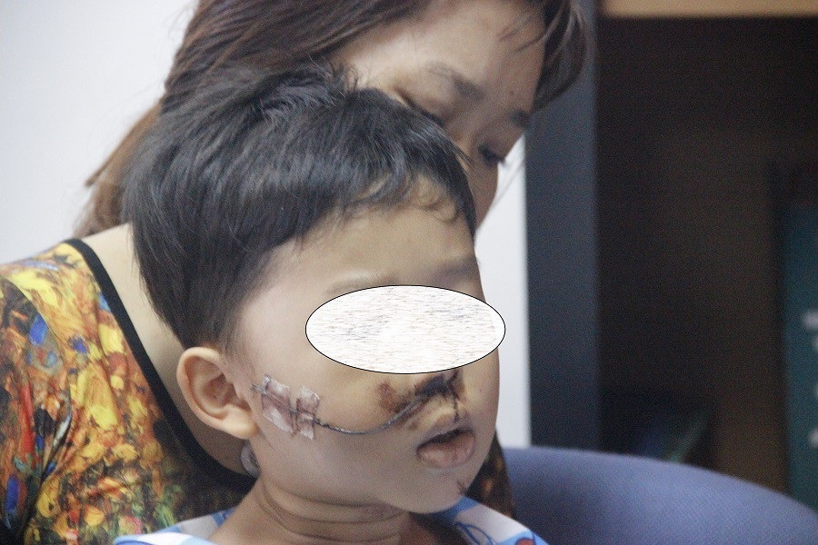 Không được đội nón bảo hiểm, nhiều trẻ bị tai nạn thương tâm - Ảnh 2. Không được đội nón bảo hiểm, nhiều trẻ bị tai nạn thương tâm - Ảnh 2.