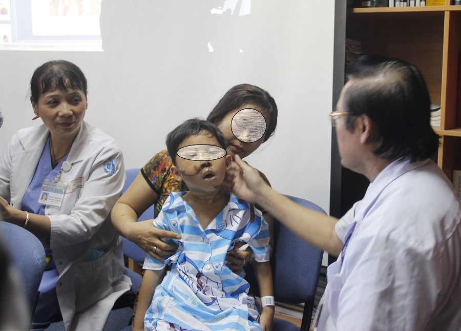 Không được đội nón bảo hiểm, nhiều trẻ bị tai nạn thương tâm - Ảnh 1. Không được đội nón bảo hiểm, nhiều trẻ bị tai nạn thương tâm - Ảnh 1.