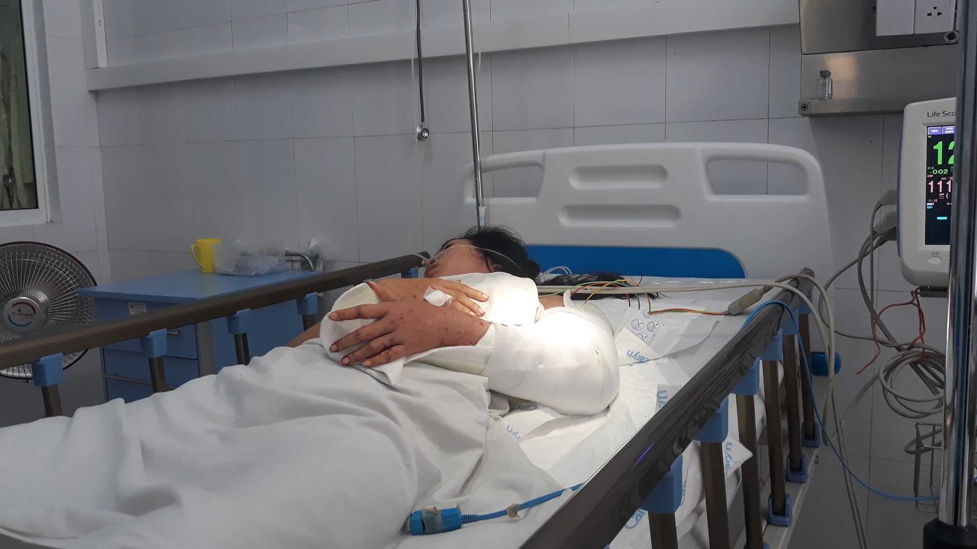 Cánh tay được nối liền của nữ sinh trong vụ rơi xe ở đèo Hải Vân đang phục hồi - Ảnh 1. Cánh tay được nối liền của nữ sinh trong vụ rơi xe ở đèo Hải Vân đang phục hồi - Ảnh 1.
