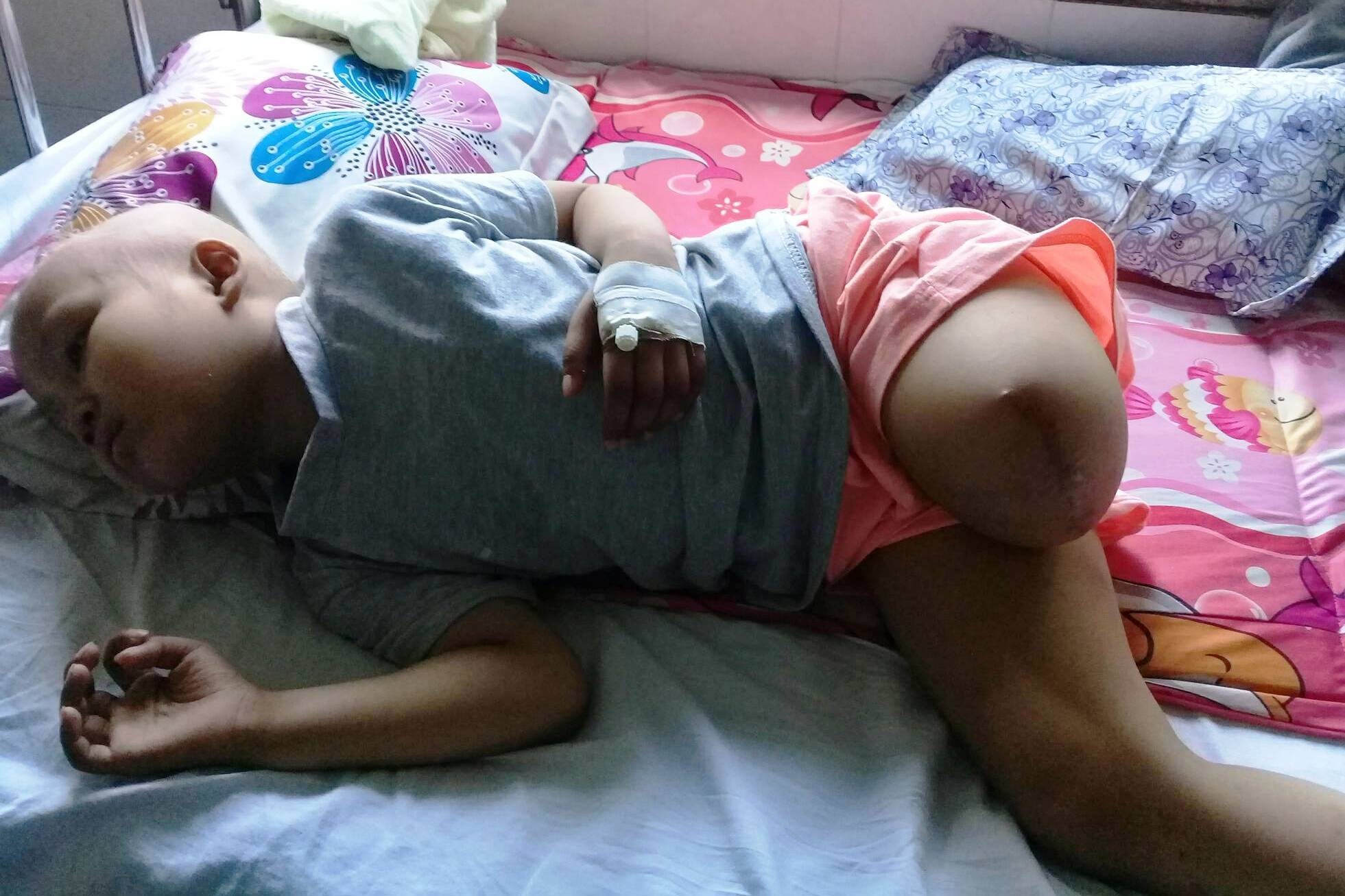 Ước mơ đến trường của cô bé mất 1 chân vì bệnh ung thư - Ảnh 5. Ước mơ đến trường của cô bé mất 1 chân vì bệnh ung thư - Ảnh 5.